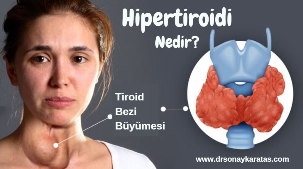 hipertiroidi nedir