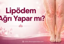 Lipödem Ağrı Yapar mı? lipödem ağrı yapar mı