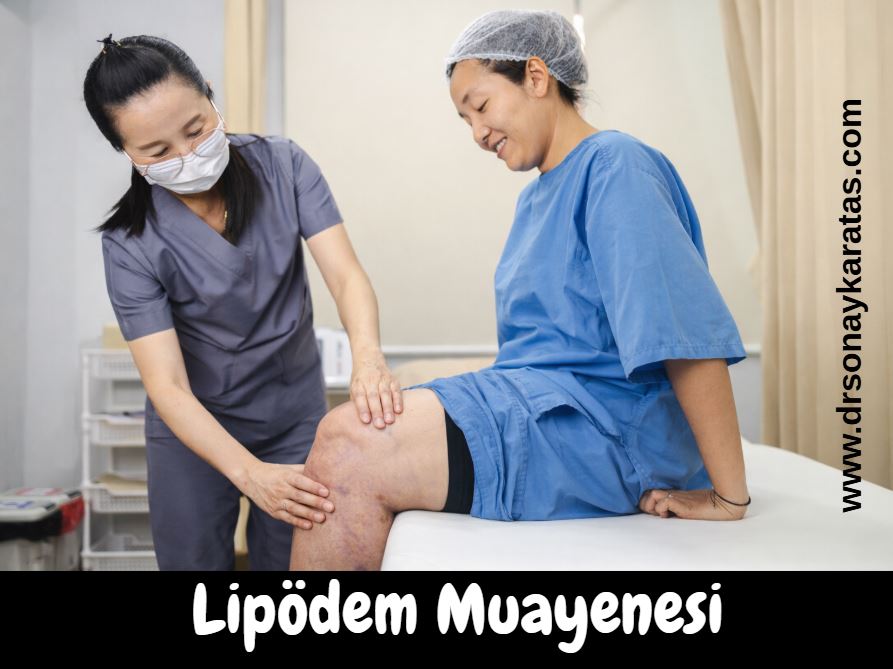lipödem muayenesi